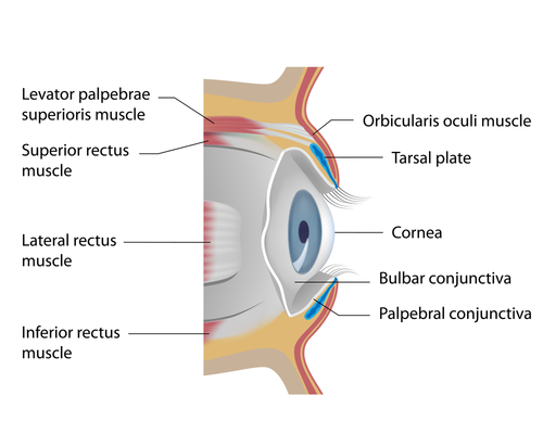uitsterven Pardon reparatie Can a Contact Lens get lost or stuck in my Eye? :: Eye Health Central