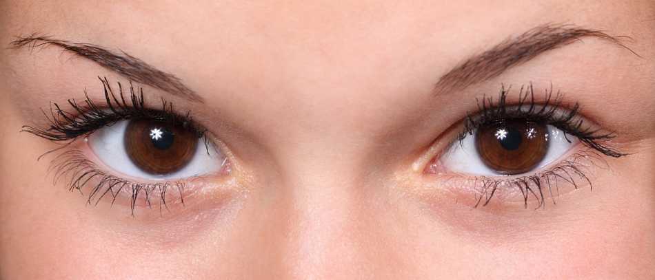 Amber Eyes - All About Vision